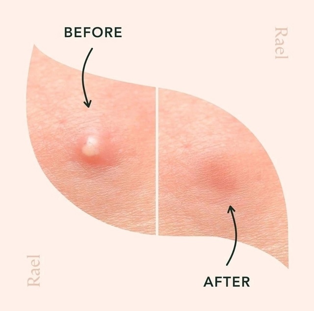 Артикул 22989155