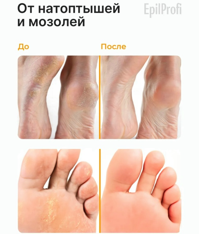 Крем+Воск от трещин 23090380